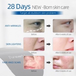 PDT LED face mask - light therapy - skin tightening / rejuvenation / dark spots remover - 7 colorsMouth masks