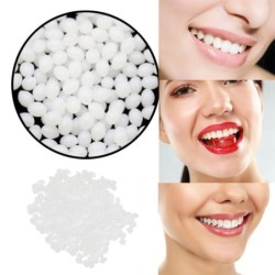 Temporary teeth repair kit - gaps filler - denture glueTeeth Whitening