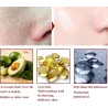 Face lift essence - anti-aging - whitening - wrinkle removal face cream with hyaluronic acidSkin